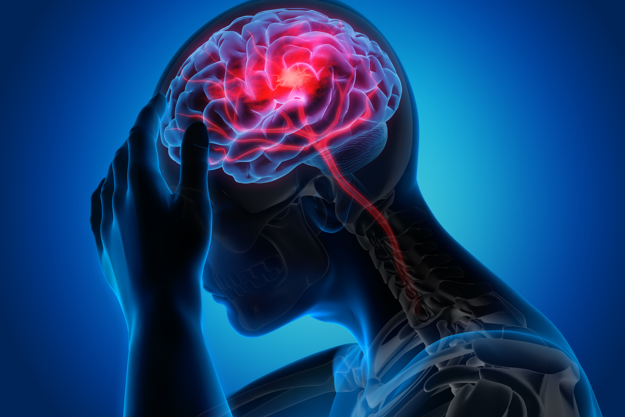Neurology ： 随访20年，哪些因素影响脑中风发作的风险