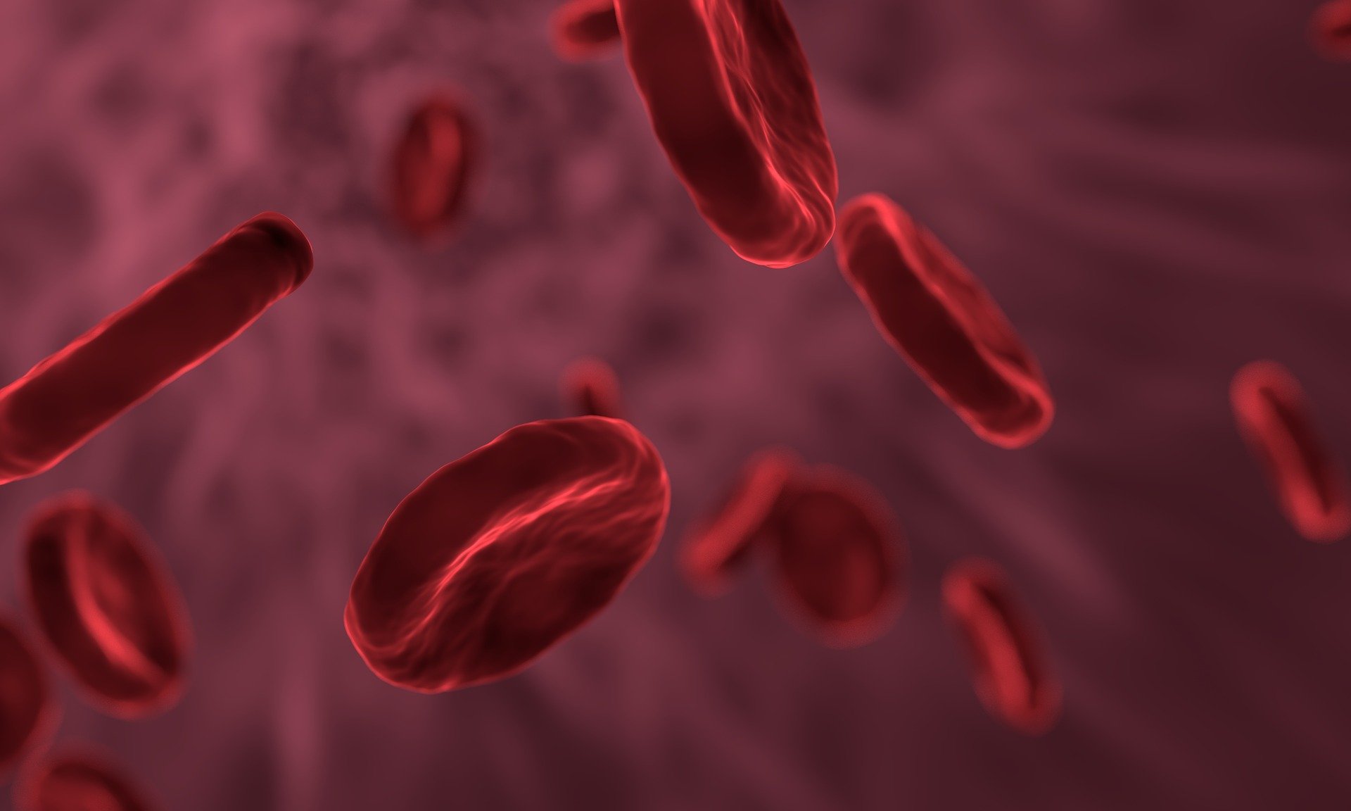 2021 BSH指南：血红蛋白<font color="red">病</font>和罕见贫血患者铁超载的监测和管理
