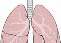 【科室宣教】肺炎——威胁老年人的健康