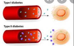 Diabetes Care：机器学习优化<font color="red">糖尿病</font>和<font color="red">冠心病</font>的亚型