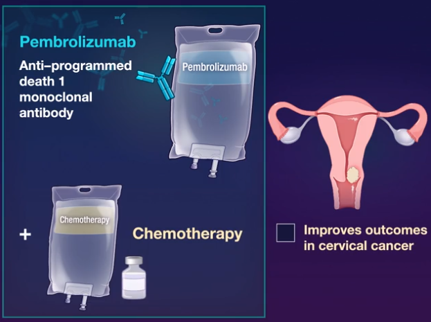 NEJM：派姆单抗治疗持续性、复发性或转移性宫颈癌的效果如何？