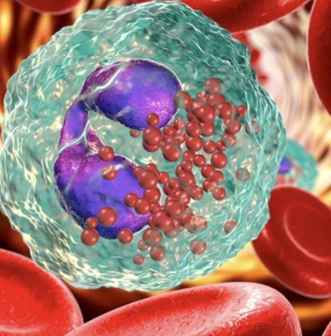 FDA授予IL-5抑制剂Fasenra（贝那利珠单抗）快速通道资格，用于治疗嗜酸性<font color="red">粒细胞</font>性胃炎（EG）