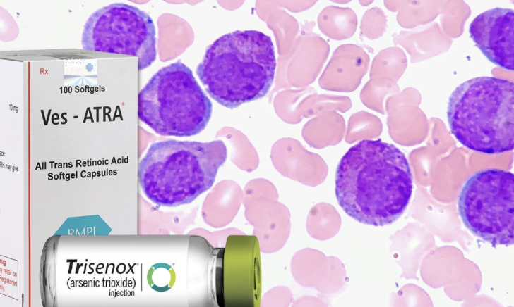 JAMA Oncology：全反式视黄酸联合三<font color="red">氧化</font>二砷，对儿童白血病疗效显著