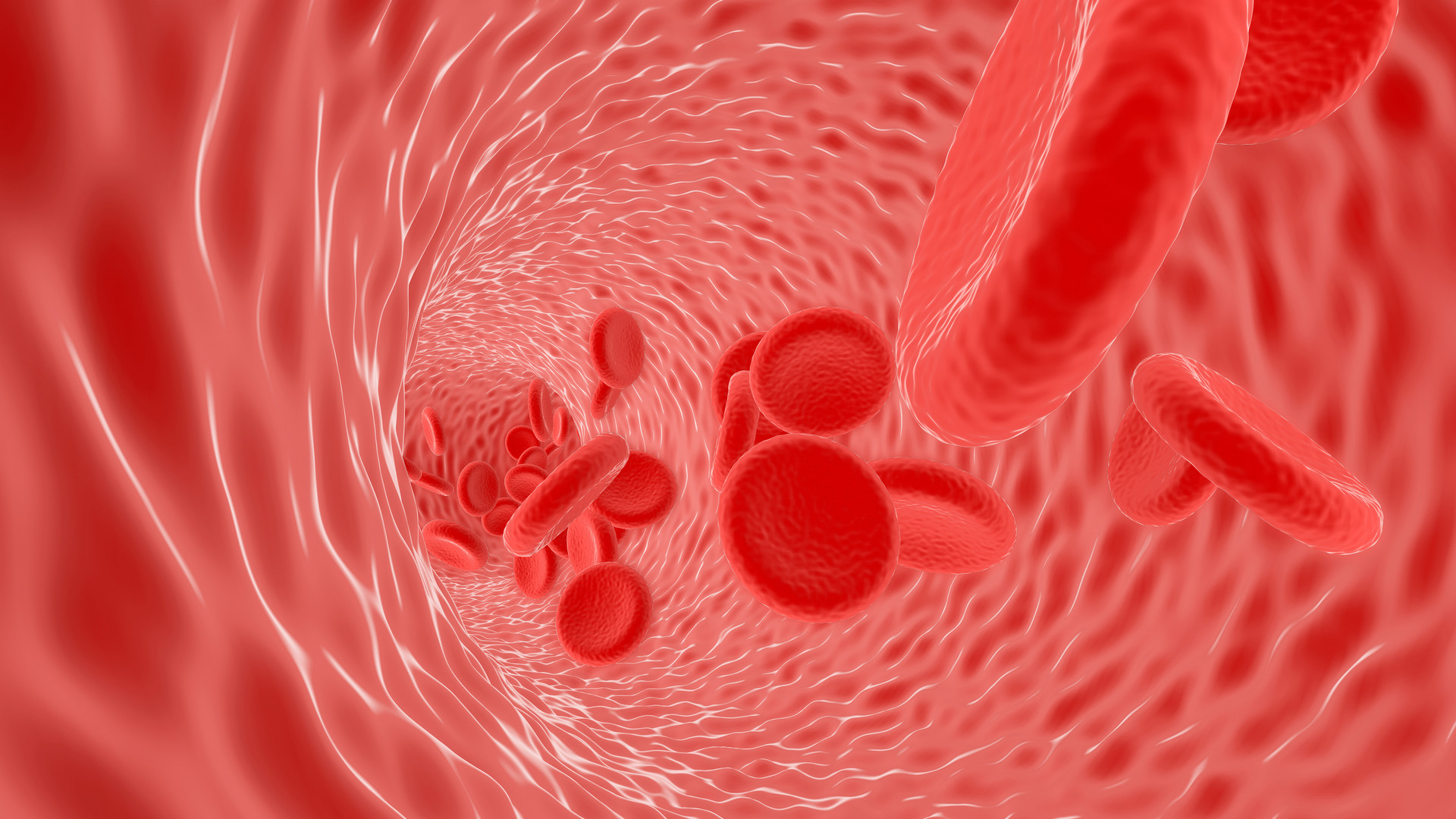 Lancet Rheumatology: 原发性系统性血管炎或风湿性多肌<font color="red">痛</font>患者COVID-19的结果：一项回顾性队列研究