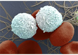 J Immunother Cancer：英夫利昔单抗((infliximab)和维多珠单抗(<font color="red">vedolizumab</font>)) 治疗免疫介导的腹泻和结肠炎(IMDC)的疗效和安全性