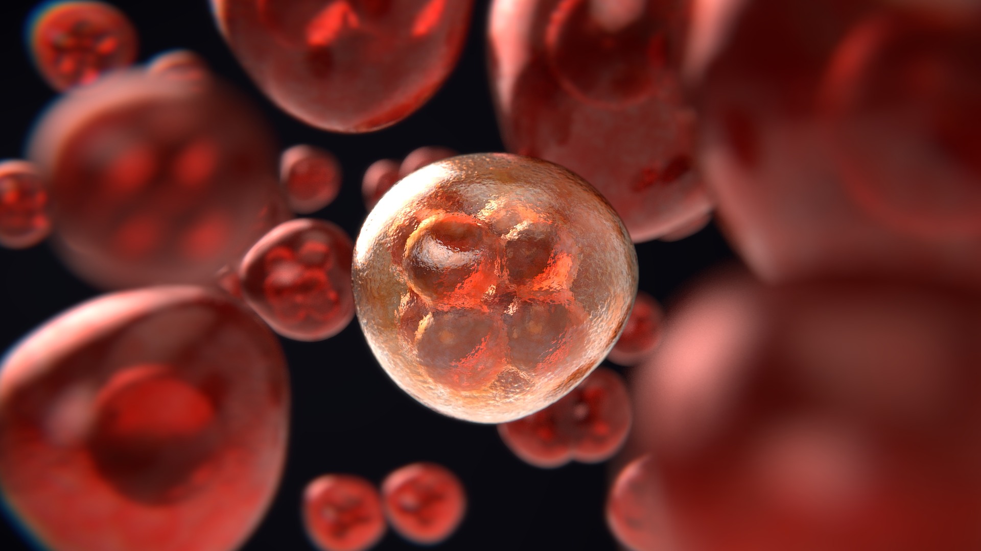 SEOM 成人髓母细胞瘤治疗临床指南（2020）