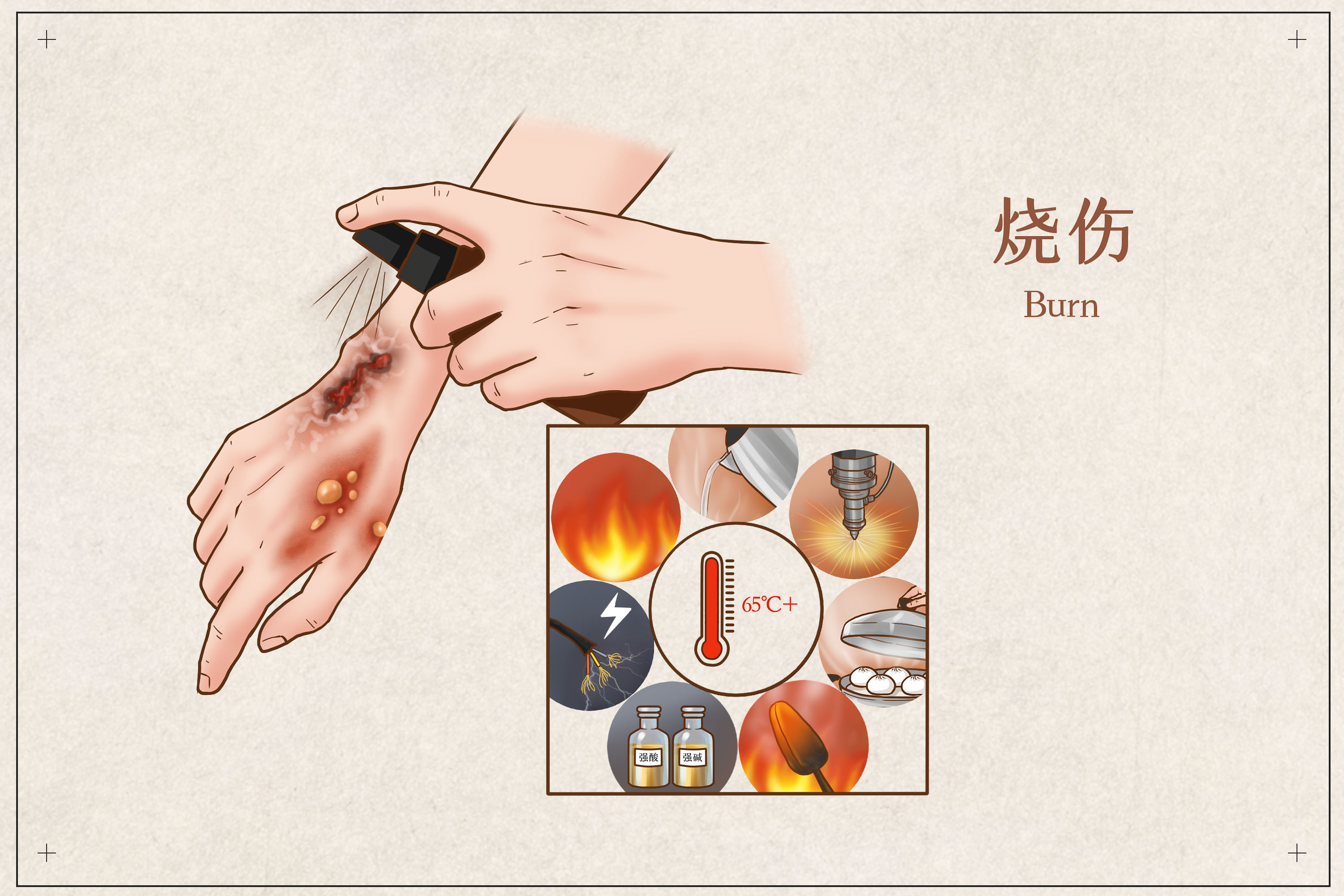 关于烧伤，您需要知道的“体位摆放”-健康科普-武汉市第三医院|武汉大学同仁医院