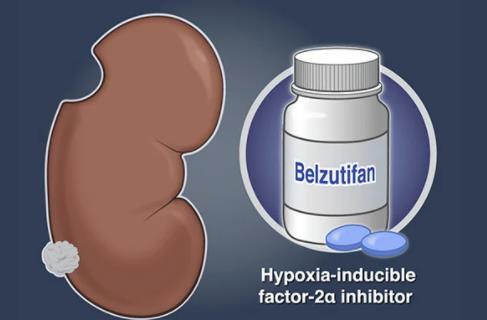 NEJM：Belzutifan治疗逢希伯-林道综合征（VHL）相关肿瘤效果显著