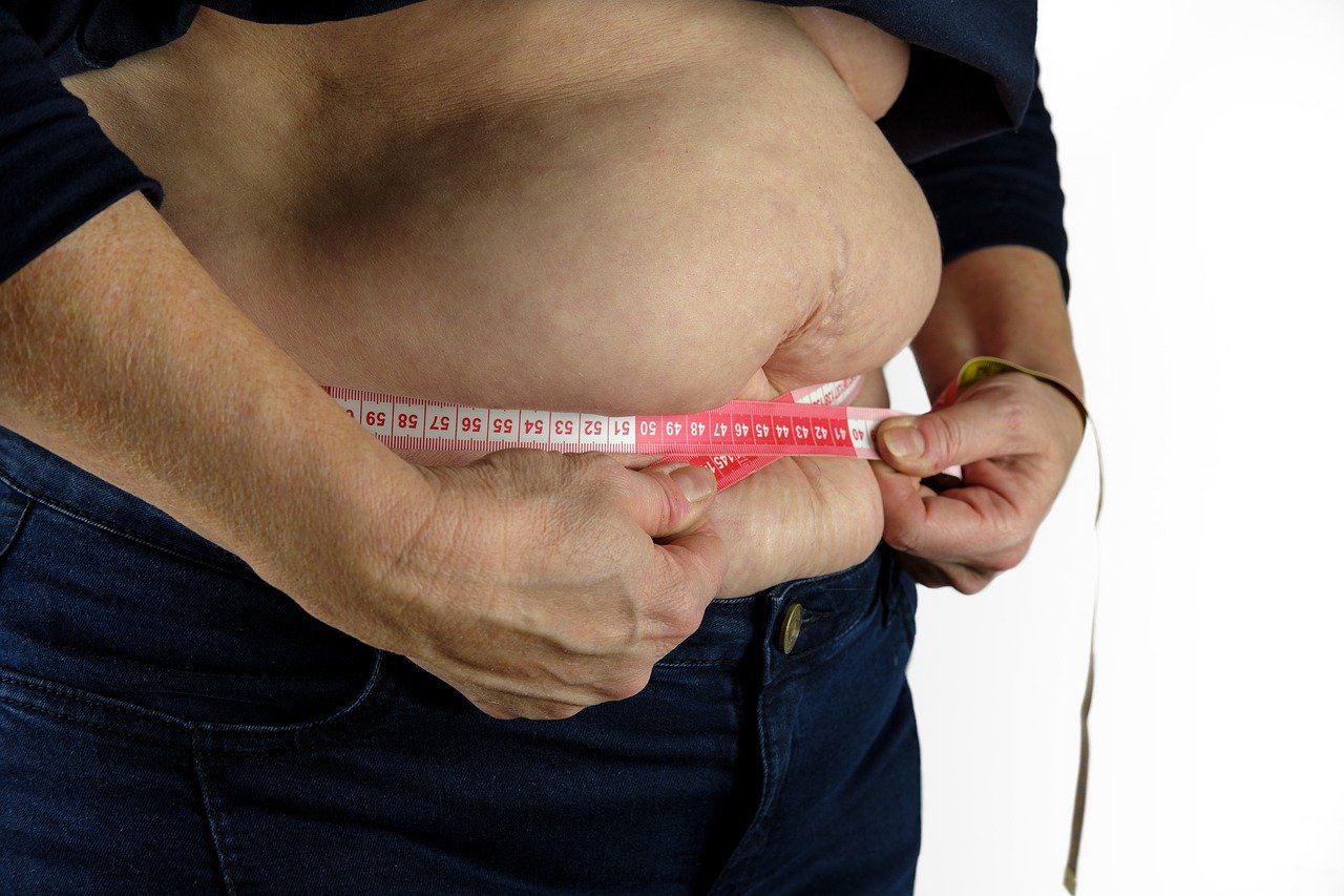 中国超重/肥胖医学营养治疗指南