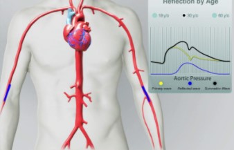 ATVB：“心脑相连”——主动脉脉搏波速度加快影响大脑灰质和白质病变