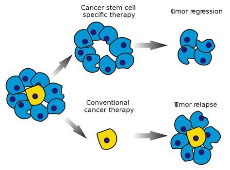 消灭癌症干细胞，小鼠多发性骨髓瘤得到治疗