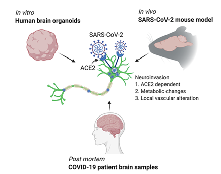J Exp Med：SARS-CoV-2可感染<font color="red">神经细胞</font>，并导致组织损伤