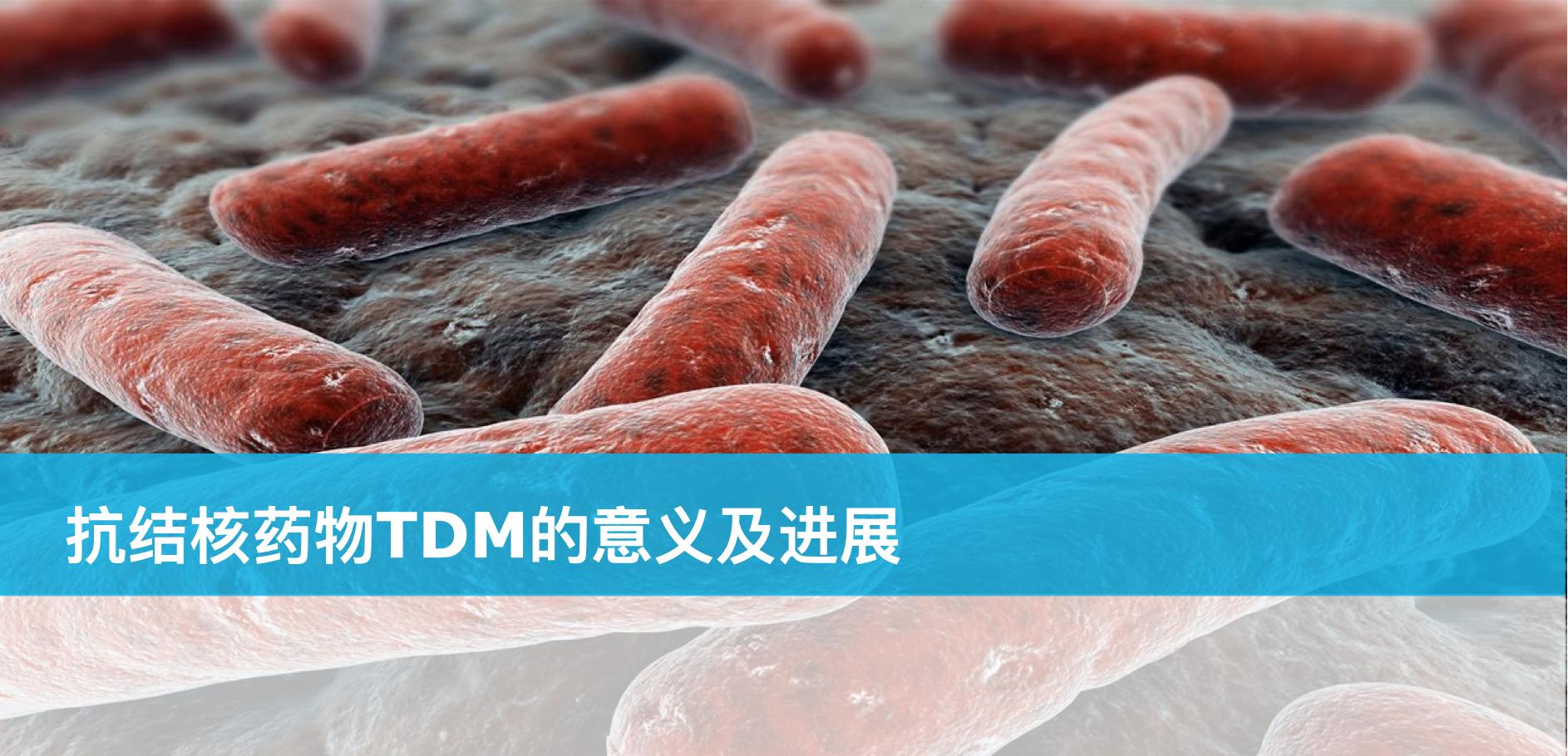 张侠：抗结核药物TDM的意义及进展
