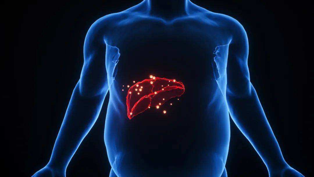AP&T:司美鲁<font color="red">肽</font>可以降低非酒精性脂肪性肝病的肝脏脂肪变性，但没有减少肝脏硬化