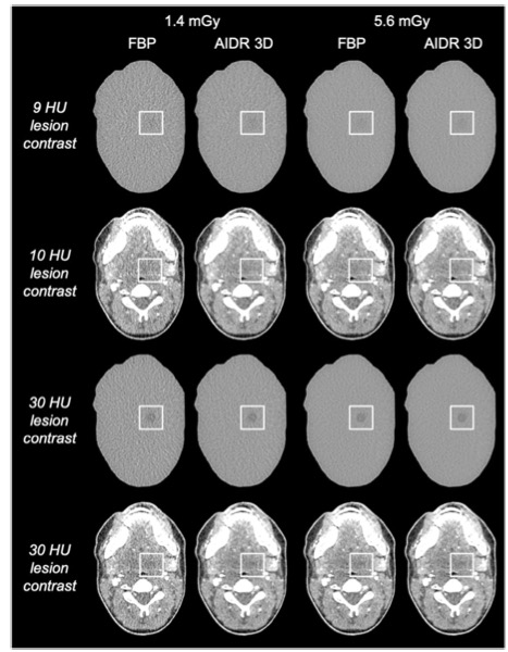 European Radiology：究竟是什么影响了CT图像质量的评估？