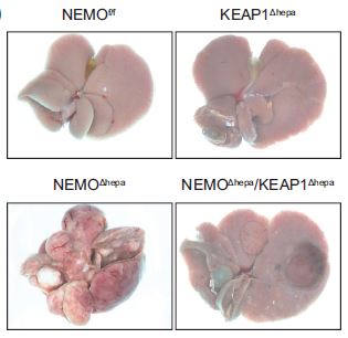 J Hepatol：肝细胞NRF2<font color="red">特异性</font>激活调控肝<font color="red">纤维化</font>和肝癌的发生