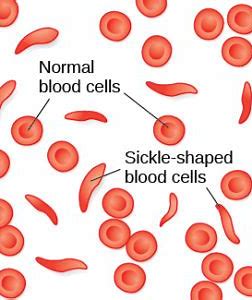 欧洲药品管理局（EMA）开始审查GBT的镰状细胞疗法<font color="red">Oxbryta</font>