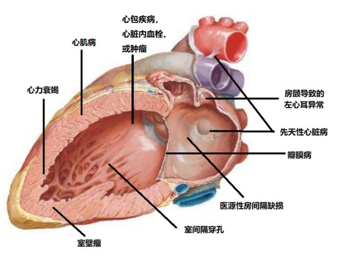 葛均波：结构性心脏病的定义、范畴以及现状和未来