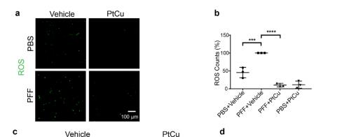 Nano Today：PtCu合金纳米酶有望治疗帕金森病