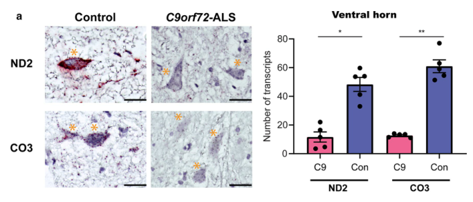 Acta Neuropathologica: C9orf72肌萎缩侧索硬化运动神经元中的线粒体生物能缺陷导致<font color="red">轴突</font>稳态失调