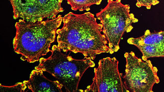 Nature Biomedical Engineering：新型纳米粒子可靶向治疗肿瘤