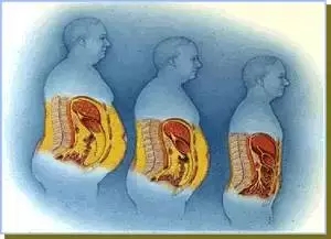 BMJ Gastroenterology：内脏脂肪<font color="red">指数</font>是大肠癌发生的预测指标