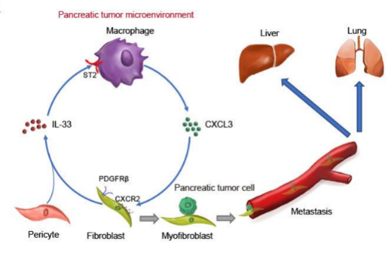 Gut：<font color="red">李琦</font>教授团队发现胰腺癌转移新机制并提出靶向治疗新策略