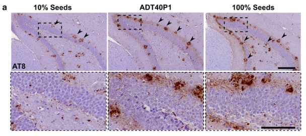 Acta Neuropathologica: 致病性tau蛋白的体外扩增保留了疾病特异性生物活性特征 