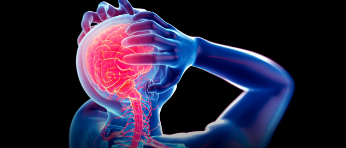 Brain：丹麦百万人研究：多次脑外伤后，癫痫风险更高！