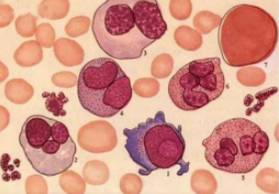 Lancet Haematol：依鲁替尼加用Ublituximab可显著提高复发性/难治性<font color="red">慢性</font>淋巴<font color="red">细胞</font><font color="red">白血</font>病患者的缓解率