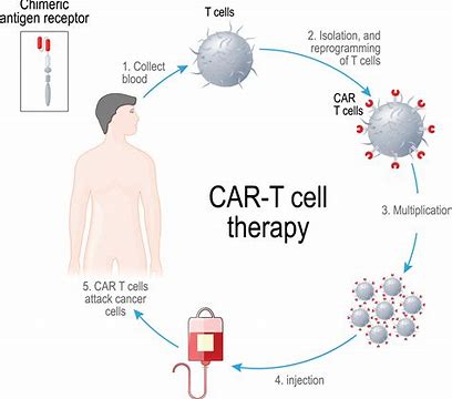 NEJM：BCMA靶向CAR-T细胞疗法Idecabtagene Vicleucel（Ide-cel）取得积极结果