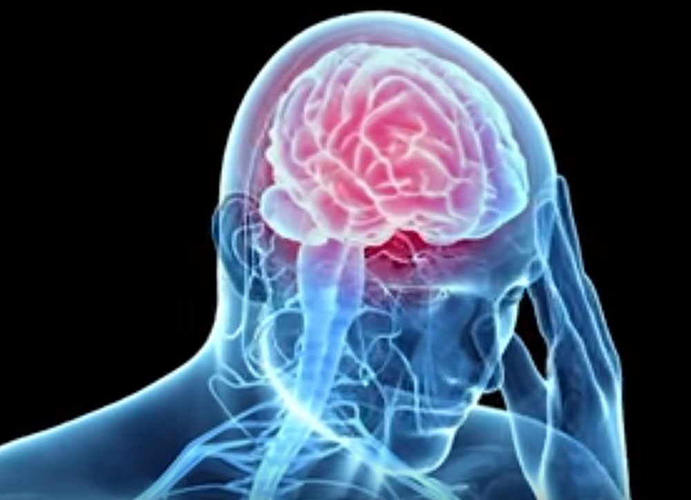 Alzheimer's Dementia：脑外伤的人，痴呆风险更高