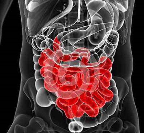 BMC Gastroenterology：粪便微生物群移植对小肠<font color="red">细菌</font>过度生长患者的临床疗效