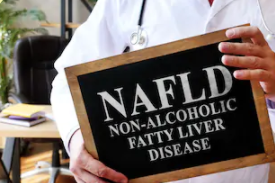 Nat Commun：双阴性T细胞抑制非酒精性脂肪性肝炎的发生发展