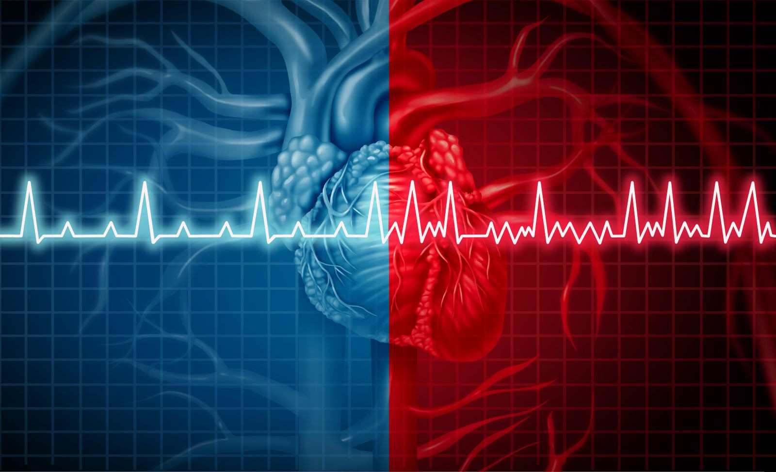 JAMA Cardiology：降低卒中、心衰风险——可穿戴式cECG可将房颤<font color="red">检出</font><font color="red">率</font>提高10倍！