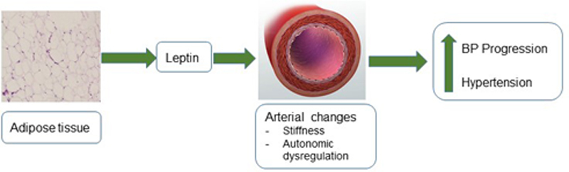 Hypertension：血浆瘦素水平和<font color="red">血压进展</font>之间的关系