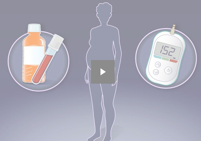 NEJM：如何更好地对妊娠期糖尿病进行筛查？