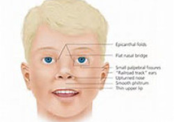 PRS：巧思！通过鼻窦粘膜影像学结果评估同种异体面部移植的排斥反应！