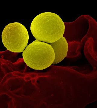 FDA批准KIMYRSA（<font color="red">奥</font><font color="red">利</font>万星）用于治疗急性细菌性皮肤和皮肤结构感染（ABSSSI）
