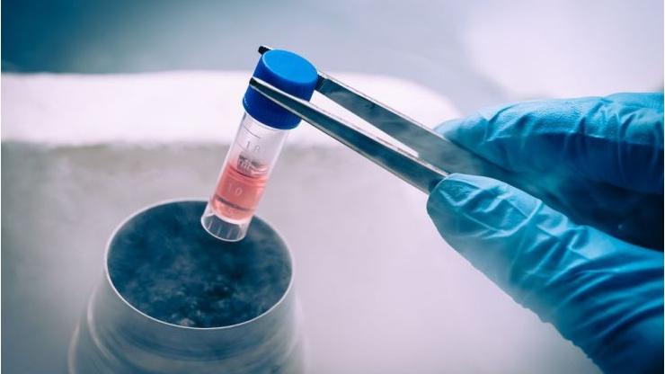 Stem Cell Research & Therapy：<font color="red">干细胞</font>与<font color="red">新</font><font color="red">冠</font><font color="red">肺炎</font>：人类羊膜<font color="red">细胞</font>是治疗SARS-CoV-2病毒的<font color="red">新</font>希望吗？
