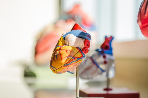 JACC子刊：冠脉迂曲病变可增加支架置入术后心血管事件死亡率！