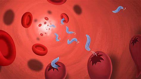 Lancet子刊：首次临床证据表明抗药性疟疾突变与延迟寄生虫清除有关