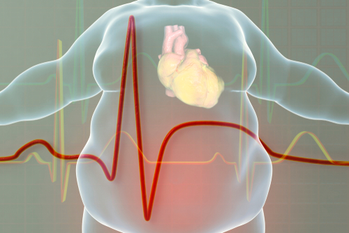 欧洲心脏病学会：补充鱼油或与心律失常有关