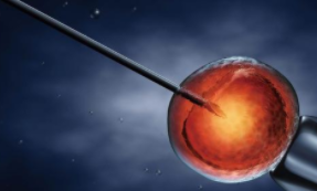 AJOG：<font color="red">三代</font><font color="red">试管婴儿</font>-植入前胚胎活检是否会影响胚胎植入后的妊娠结局？