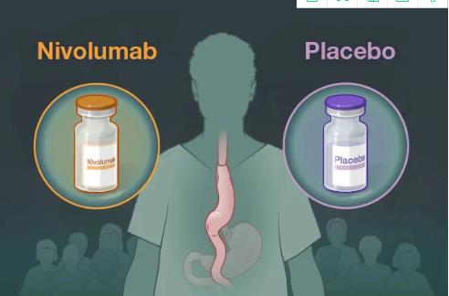 NEJM：Nivolumab辅助治疗方案用于晚期食管或<font color="red">胃</font>食管交界癌患者III期临床研究获得成功