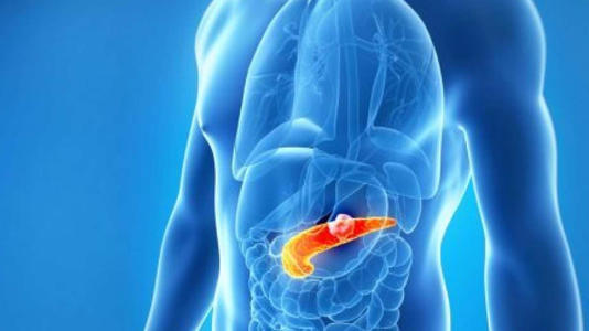 Dig Dis Sci: 胰腺囊肿患者发生胰腺癌的几率和癌症相关死亡率都较低