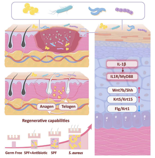 Cell Host&Microbe：<font color="red">洁癖</font>不一定是件好事！揭示细菌可促进皮肤伤口愈合和毛囊新生