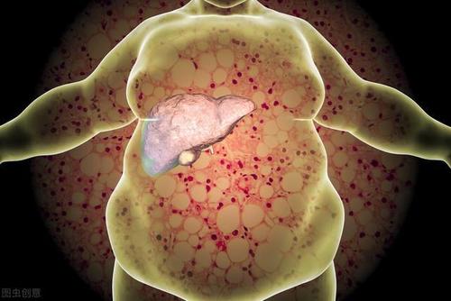 BMC Gastroenterology：人体成分组成与非酒精性脂肪肝组织学之间的关系