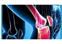 Ann Rheum Dis：华法林与膝关节和髋关节置换风险