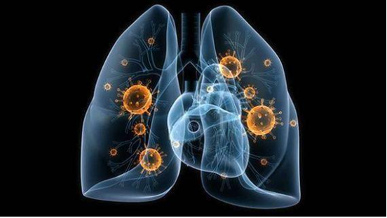 Cell Death Differ：lncRNA PFI调控SRSF1的表达及活性以预防肺纤维化的发生